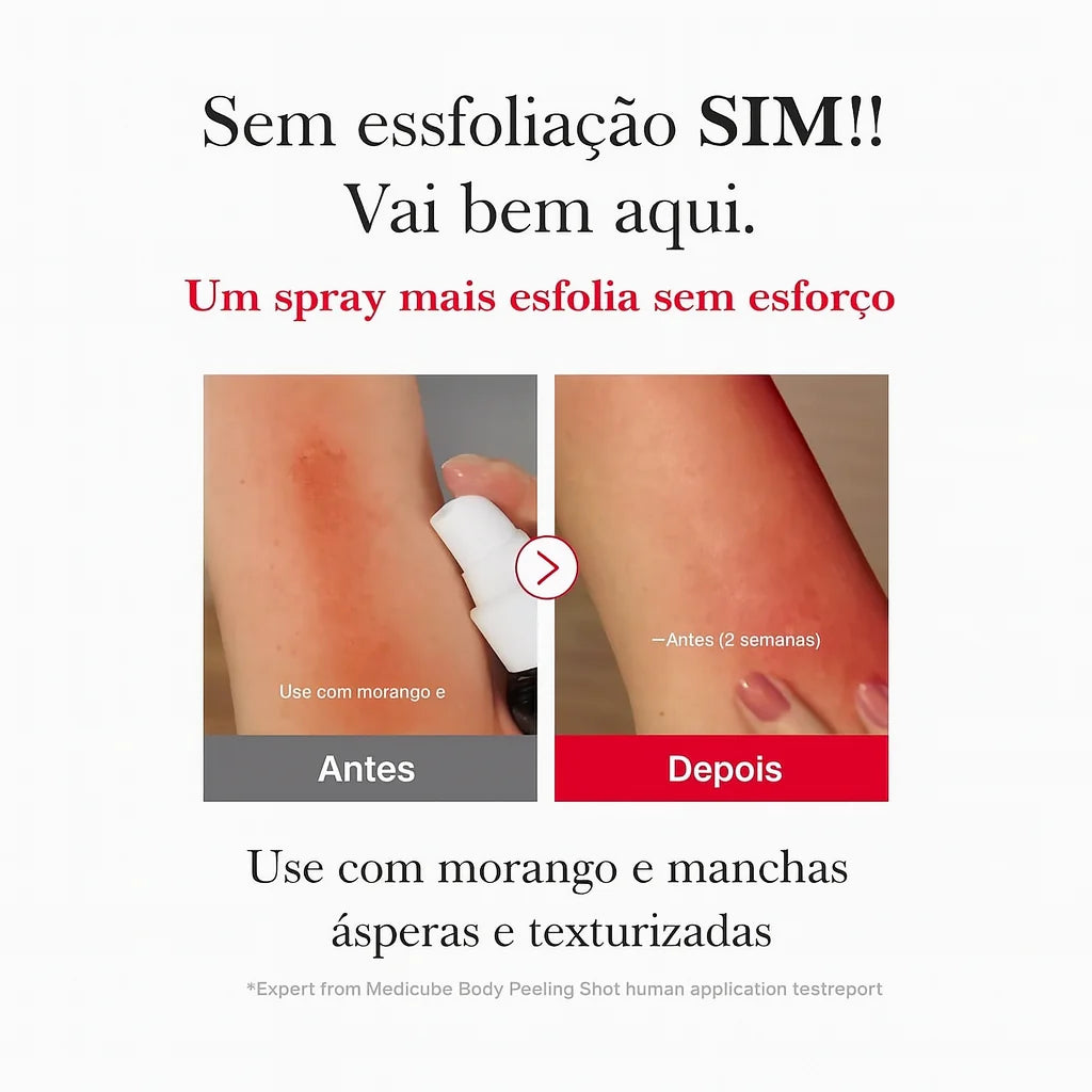 Red Acne Spray Peeling Esfoliante Corporal