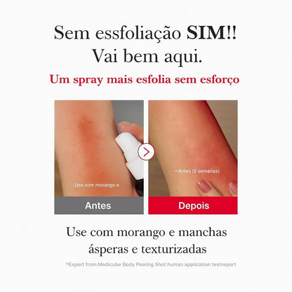Red Acne Spray Peeling Esfoliante Corporal